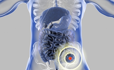 Illustration of human body, highlighting colon