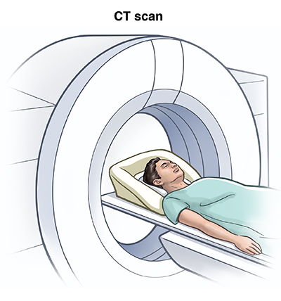 Illustration of male patient in CT scanner