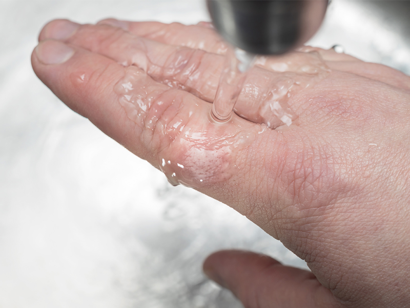 Water running over a hand