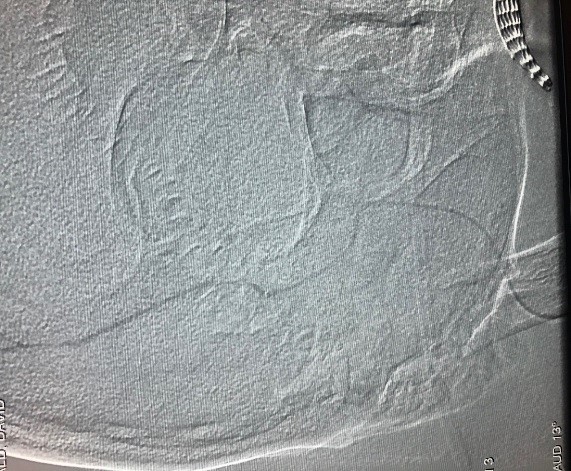 Previous Imaging for Stroke Care - Munson Healthcare