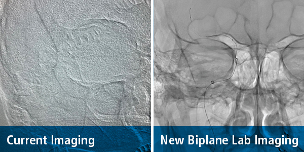 stroke biplane imaging Munson Healthcare