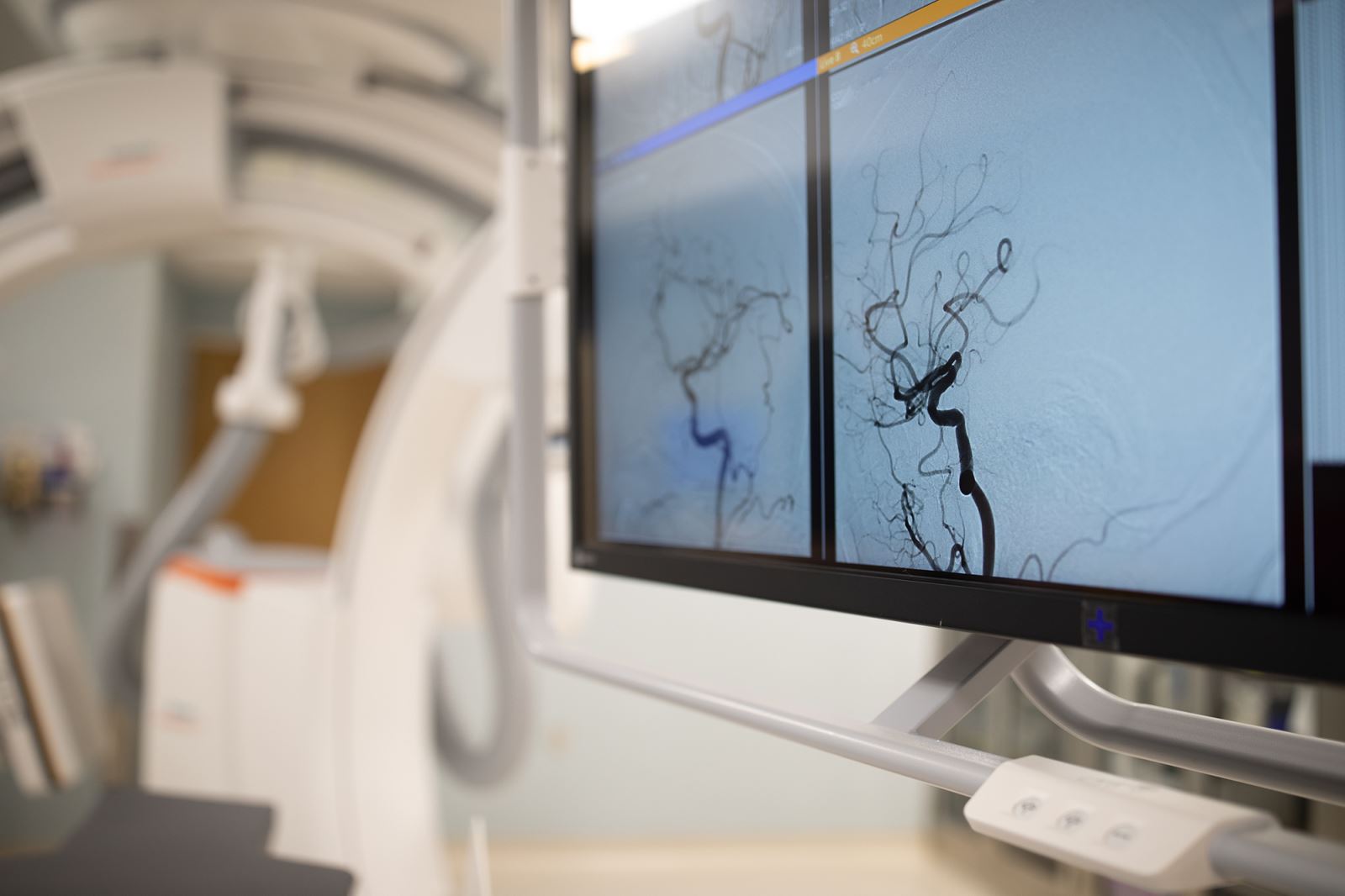 Brain scan stroke Munson healthcare