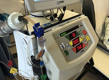 Hemodialysis machine