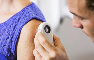 checking for skin cancer